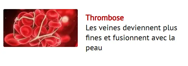 Crème Anti-Varices Venoxil