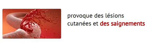 Crème Anti-Varices Venoxil