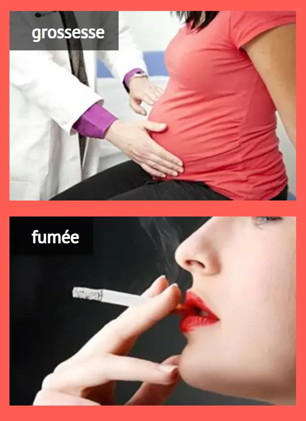 Crème Anti-Varices Venoxil